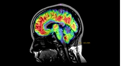 Neuro Imaging MRI