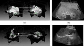 MRI