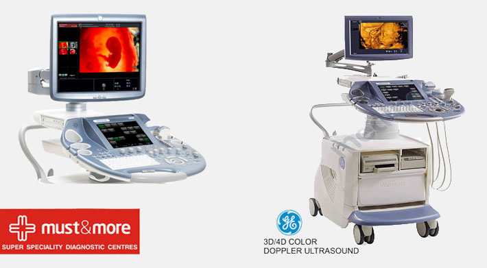 ultrasound